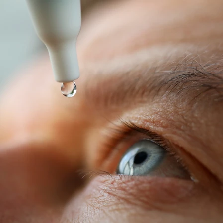 A patient with glaucoma adding eyedrops to their eye